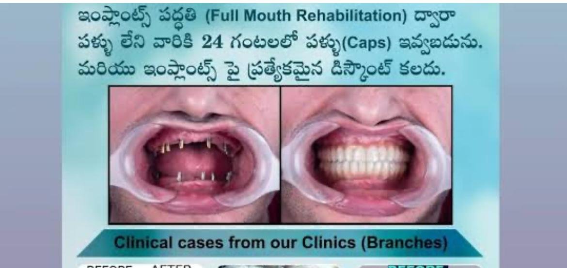 Advanced Dental Equipment